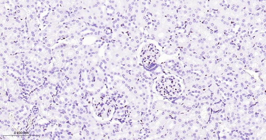 癌基因ERG重组兔单抗-bsm-52324R