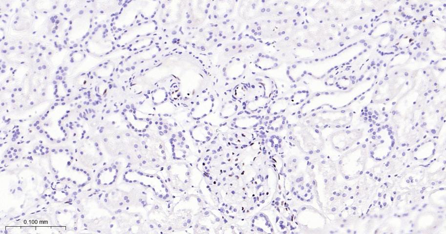 癌基因ERG重组兔单抗-bsm-52324R