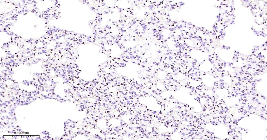癌基因ERG重组兔单抗-bsm-52324R