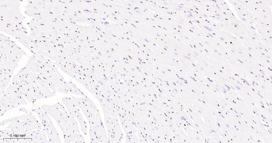 癌基因ERG重组兔单抗-bsm-52324R