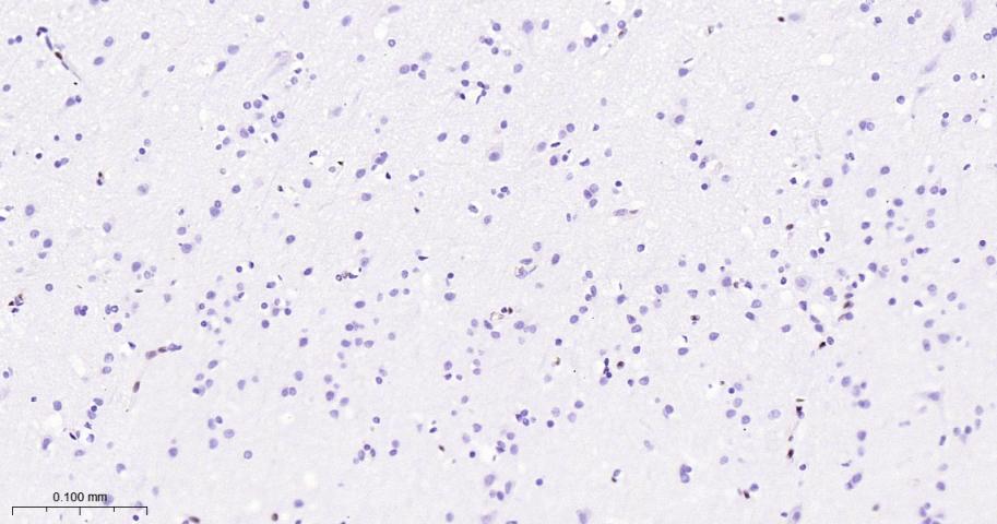 癌基因ERG重组兔单抗-bsm-52324R