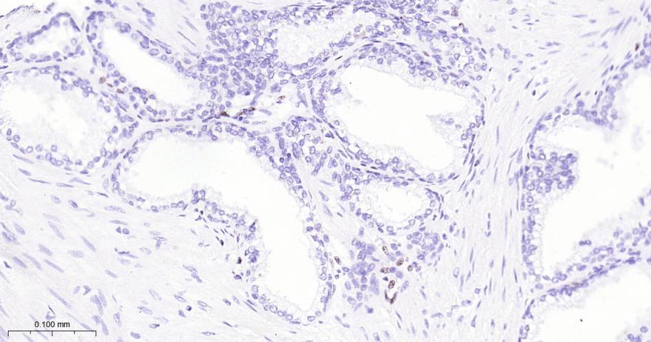 癌基因ERG重组兔单抗-bsm-52324R