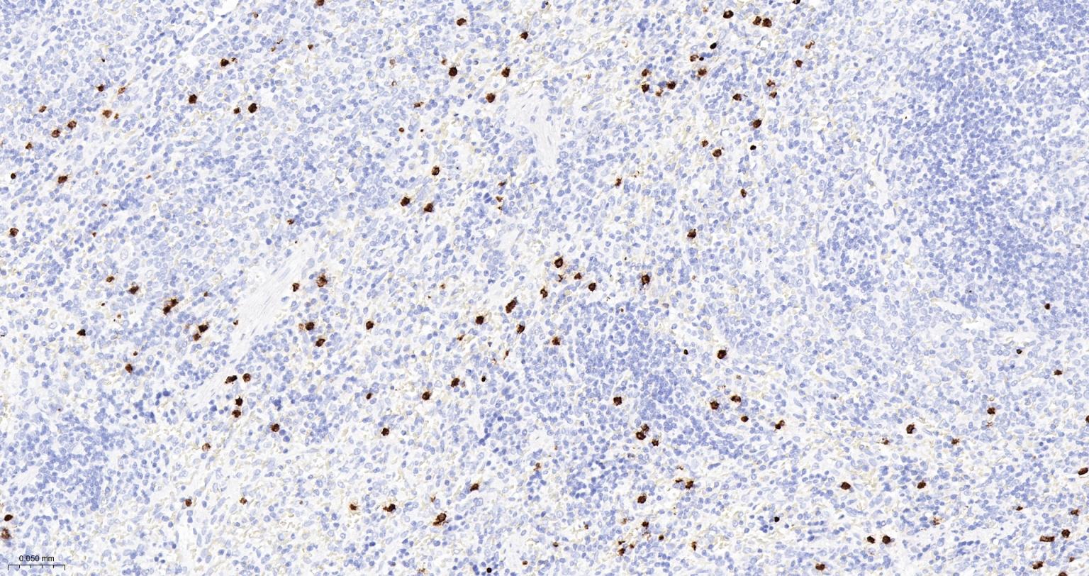 S100钙结合蛋白A8重组兔单抗-bsm-61167R
