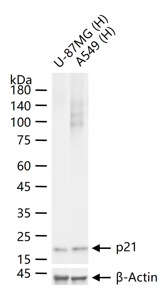 p21蛋白重组兔单抗-bsm-60698R