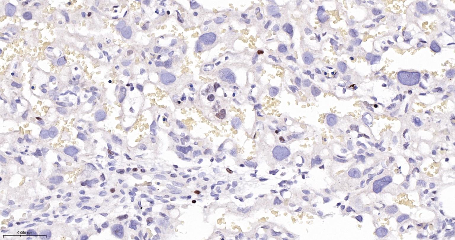 DNA甲基转移酶1重组兔单抗-bsm-61399R