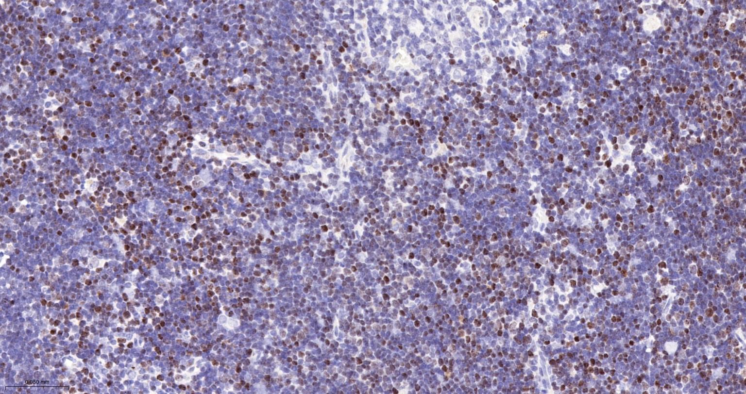 DNA甲基转移酶1重组兔单抗-bsm-61399R
