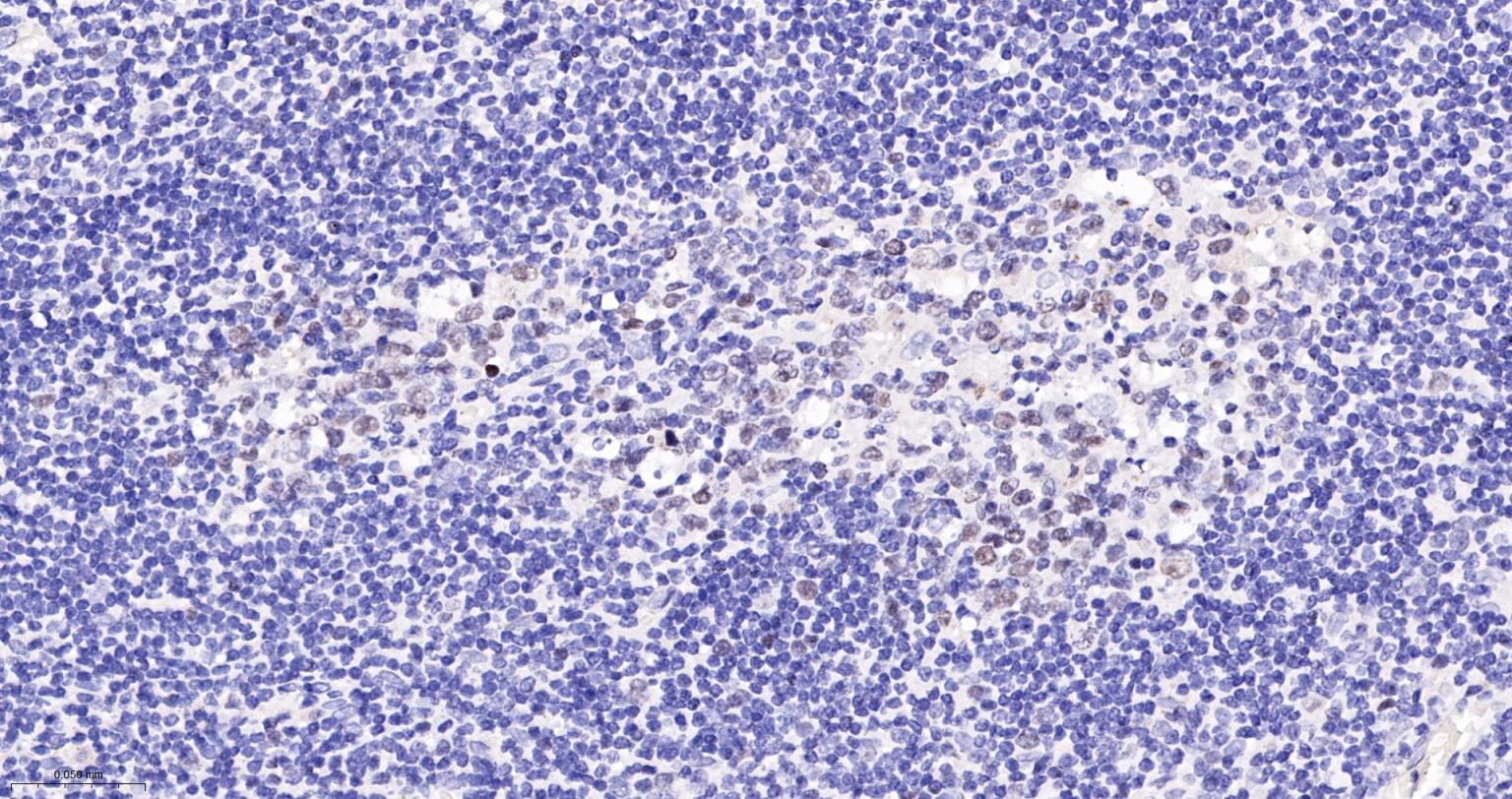 DNA甲基转移酶1重组兔单抗-bsm-61399R