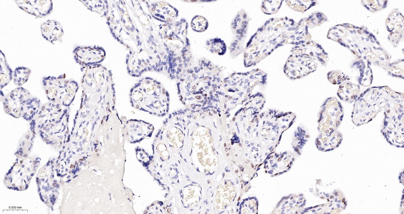 DNA甲基转移酶1重组兔单抗-bsm-61399R