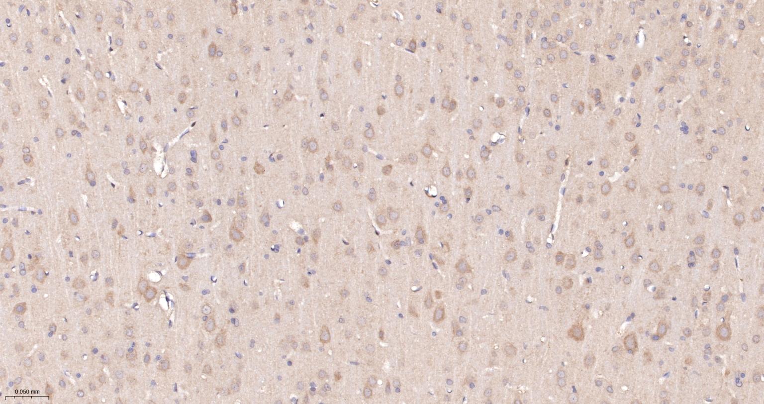促凋亡调节蛋白BNIP3重组兔单抗-bsm-61440R