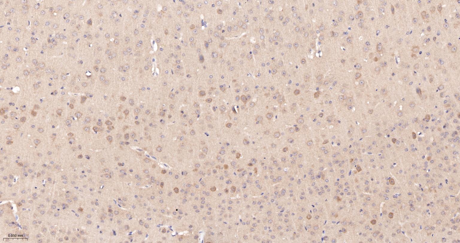 促凋亡调节蛋白BNIP3重组兔单抗-bsm-61440R