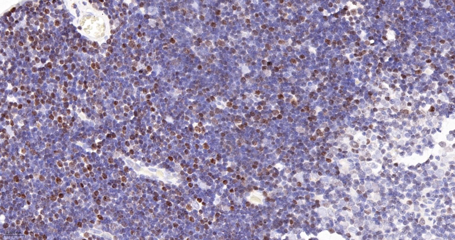 DNA甲基转移酶1重组兔单抗-bsm-61399R