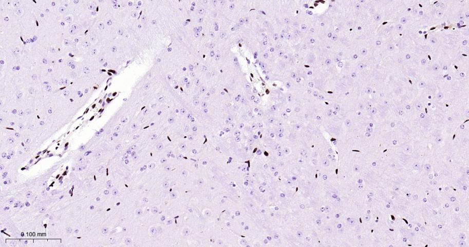 癌基因ERG重组兔单抗-bsm-52324R
