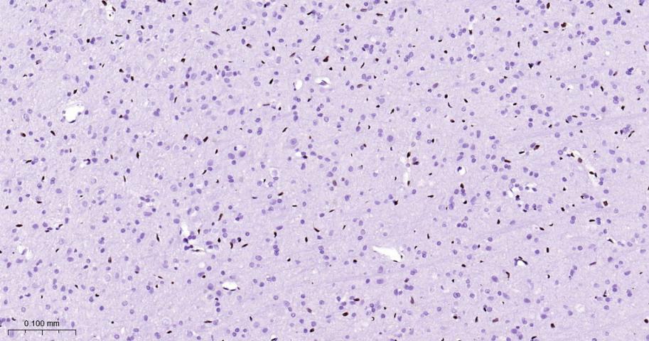 癌基因ERG重组兔单抗-bsm-52324R