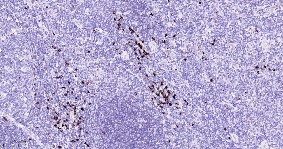人k轻链重组兔单抗-bsm-54763R