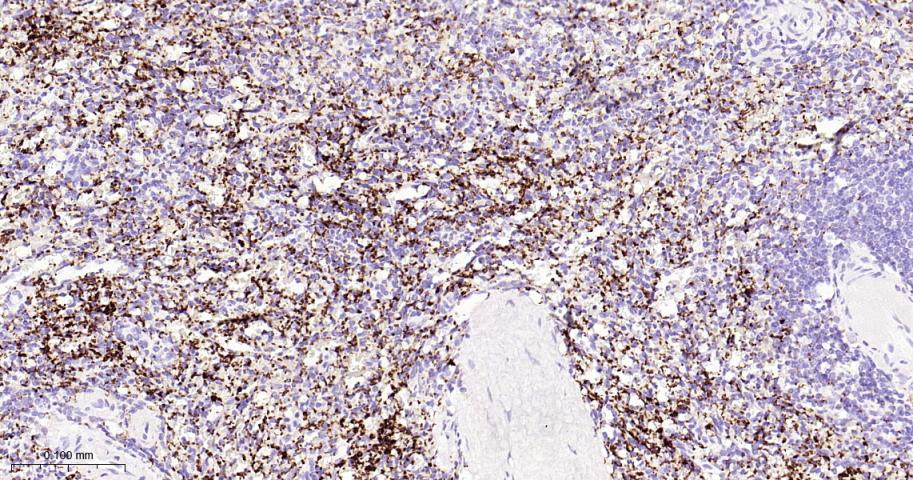 血小板糖蛋白GPIb（CD42b）重组兔单抗-bsm-60018R