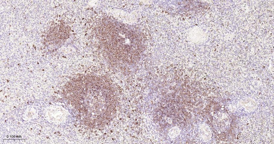 B淋巴细胞粘附分子CD22重组兔单抗-bsm-60233R