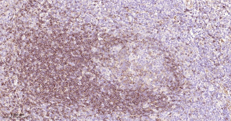 B淋巴细胞粘附分子CD22重组兔单抗-bsm-60233R