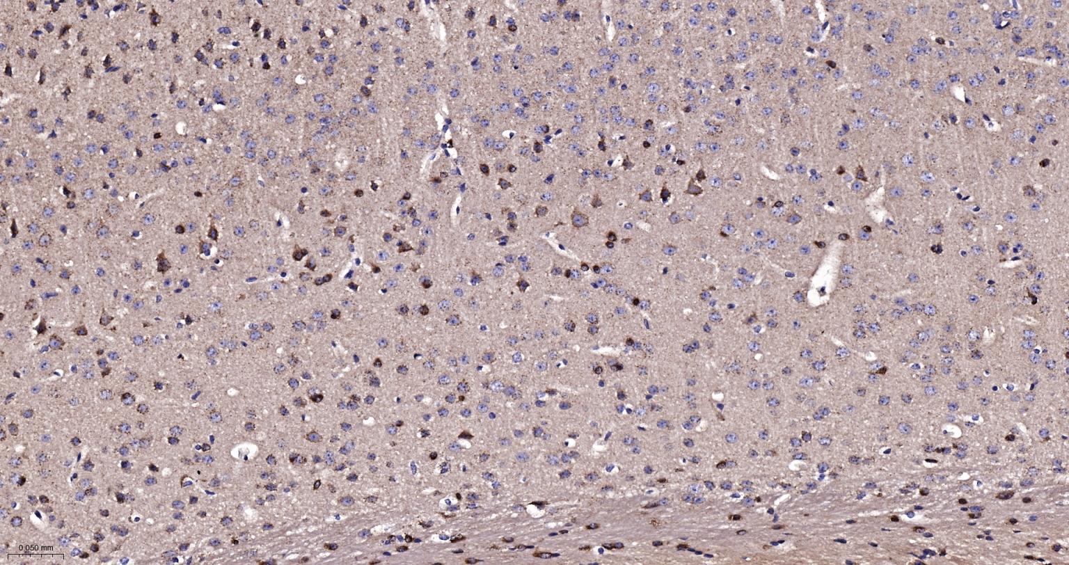 热休克蛋白10/HSPE1重组兔单抗-bsm-60471R