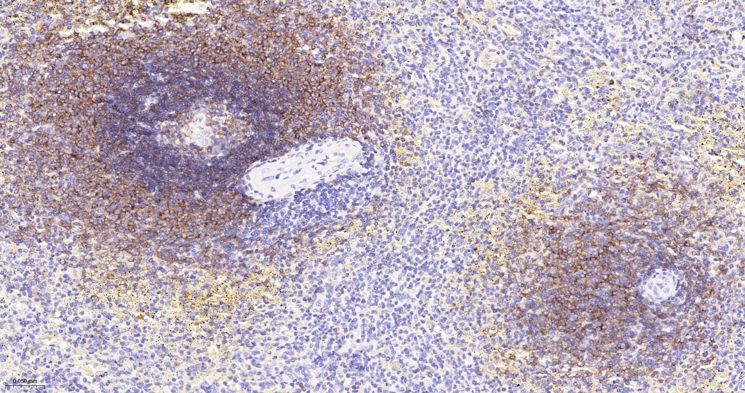 CD19重组兔单抗-bsm-60900R