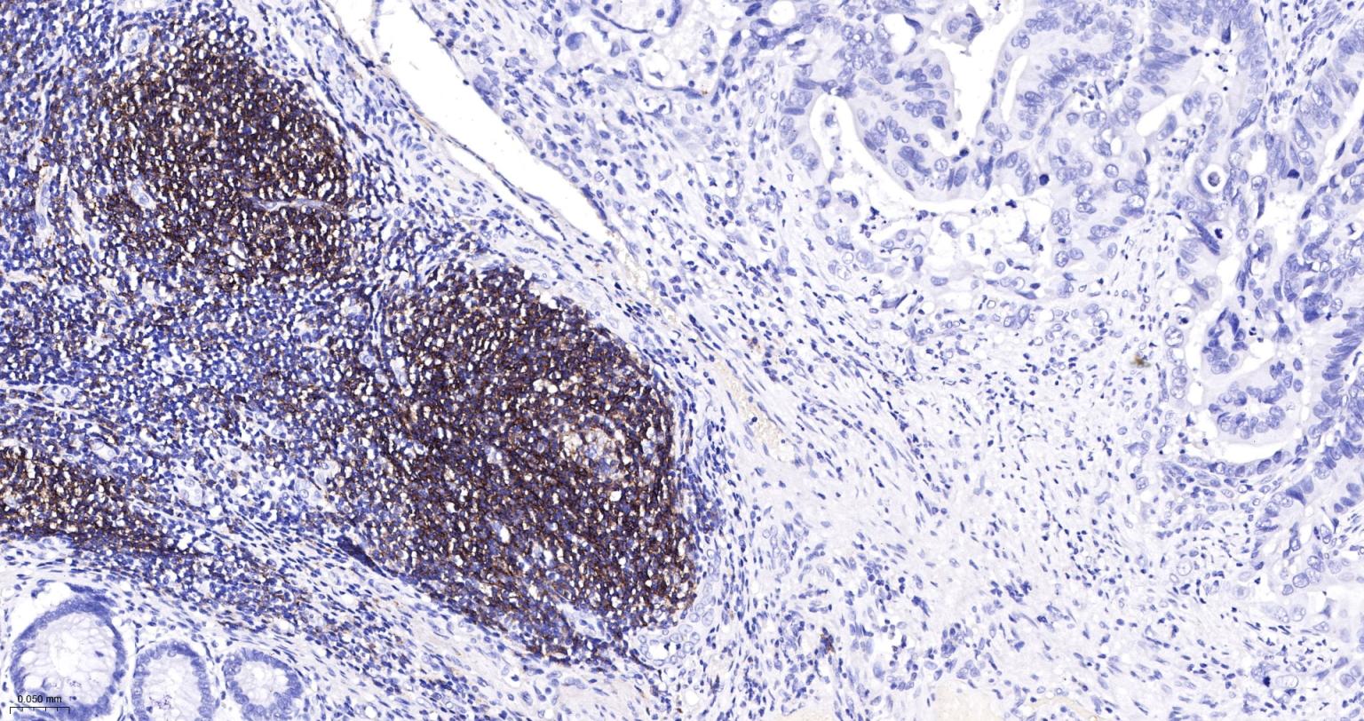 CD19重组兔单抗-bsm-60900R