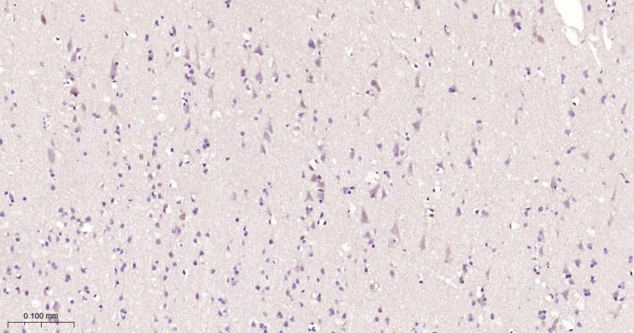 ULK3重组兔单抗-bsm-61618R