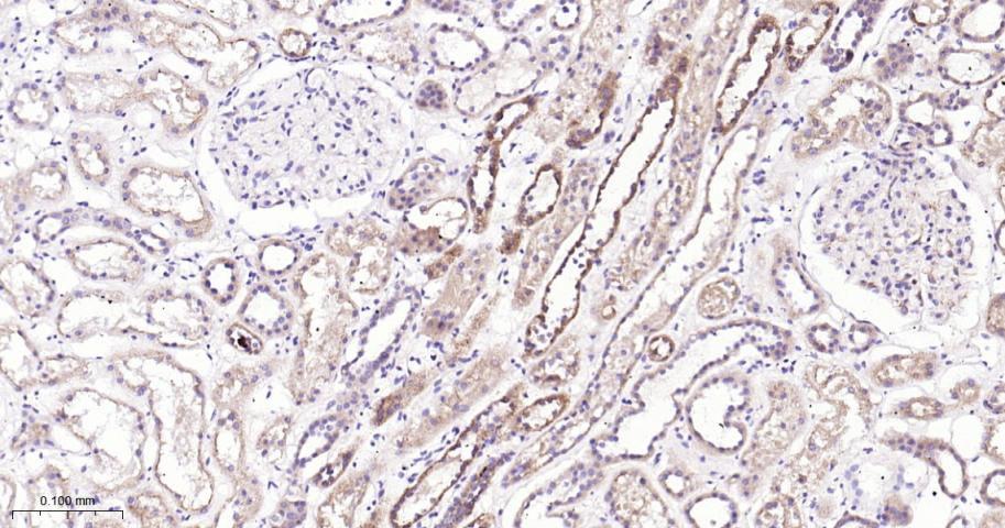 ULK3重组兔单抗-bsm-61618R