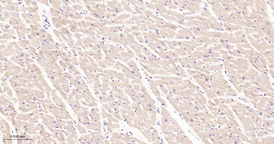 ULK3重组兔单抗-bsm-61618R