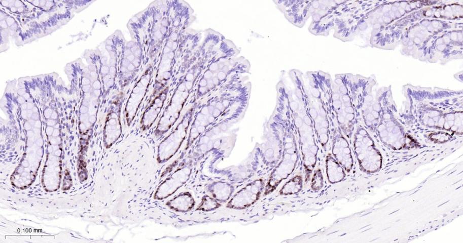 KAT1重组兔单抗-bsm-62022R