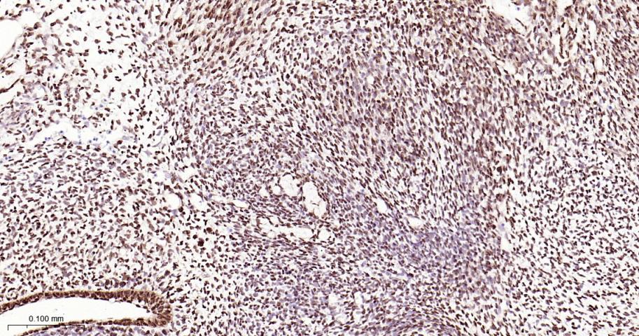 KAT1重组兔单抗-bsm-62022R