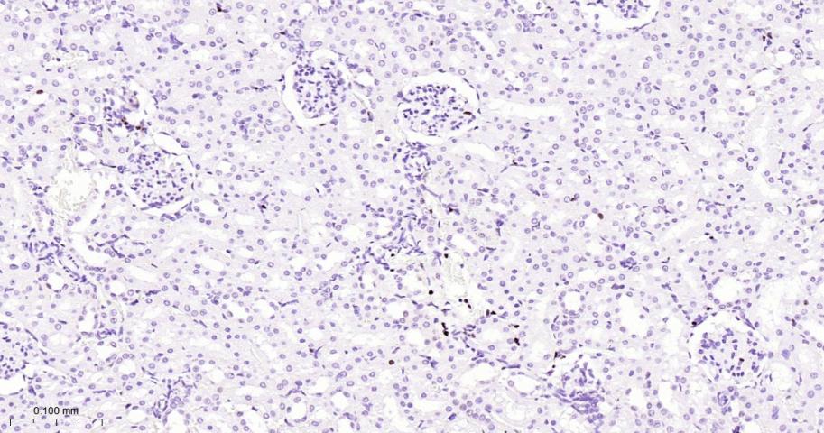 KAT1重组兔单抗-bsm-62022R