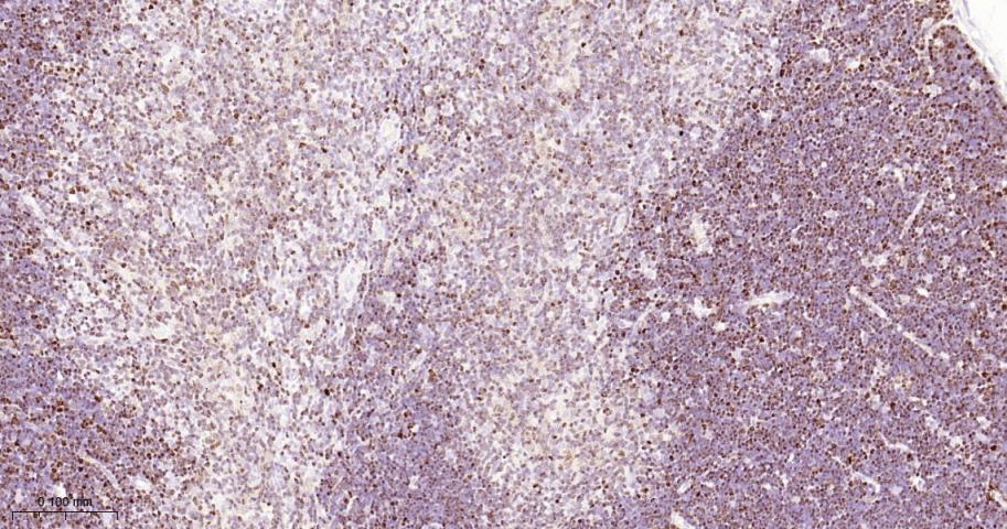 KAT1重组兔单抗-bsm-62022R