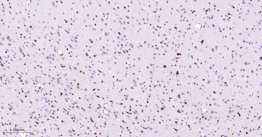 KAT1重组兔单抗-bsm-62022R