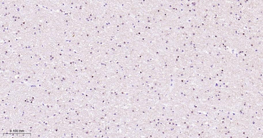 KAT1重组兔单抗-bsm-62022R