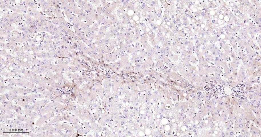 信号转导与转录激活因子1重组兔单抗-bsm-63166R
