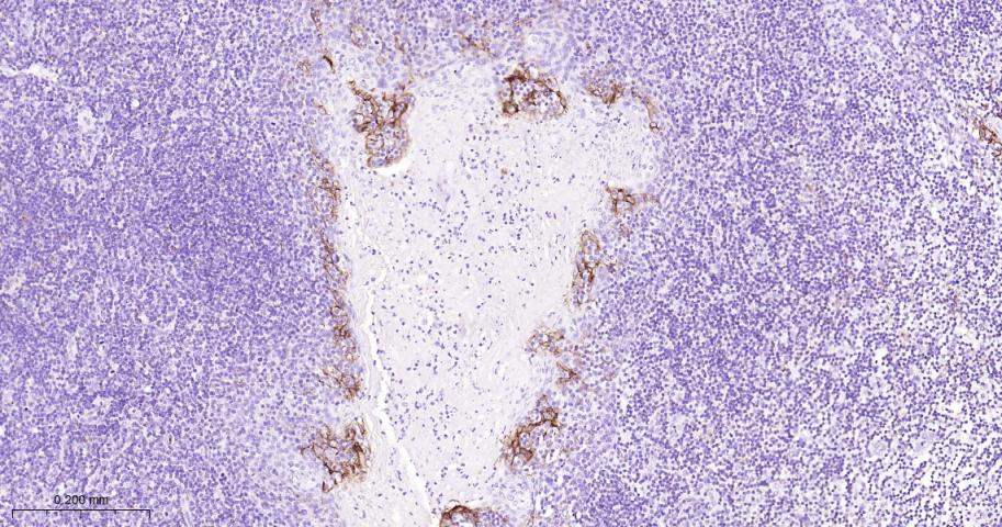 程序性死亡配体1重组兔单抗-bsm-43073R