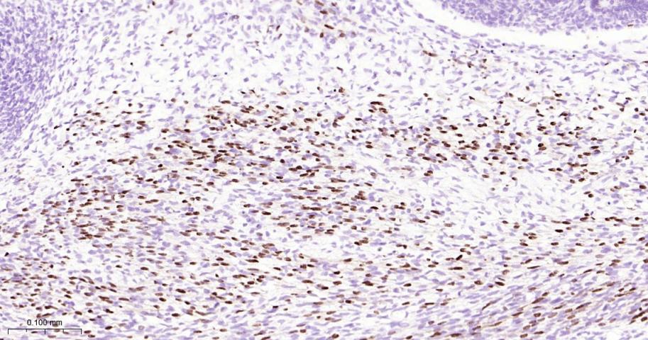 肌细胞生成素重组兔单抗-bsm-56206R
