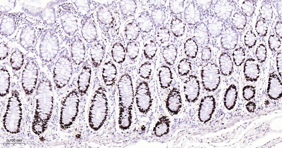 微小染色体维持缺陷蛋白2重组兔单抗-bsm-63311R
