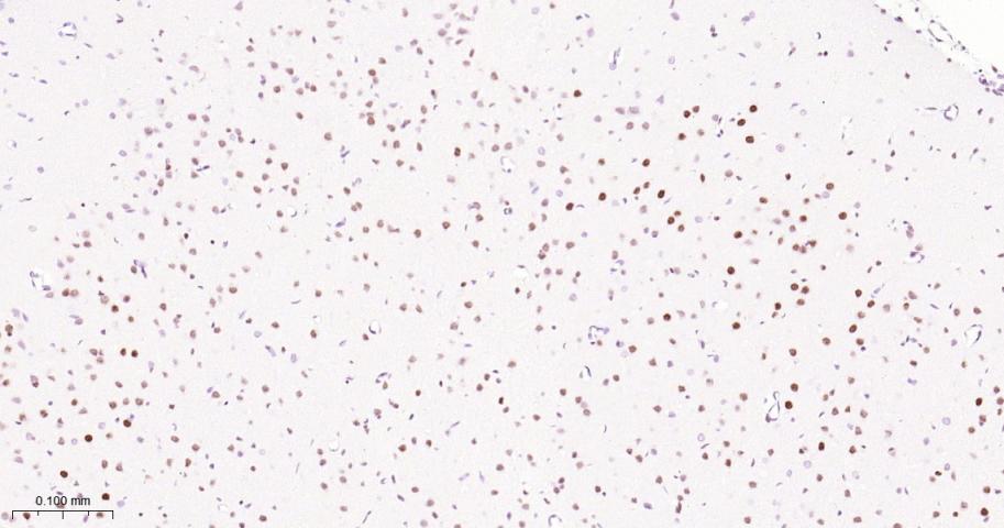 ATP依赖解旋酶SMARCA2重组兔单抗-bsm-60621R