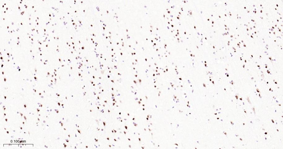 ATP依赖解旋酶SMARCA2重组兔单抗-bsm-60621R