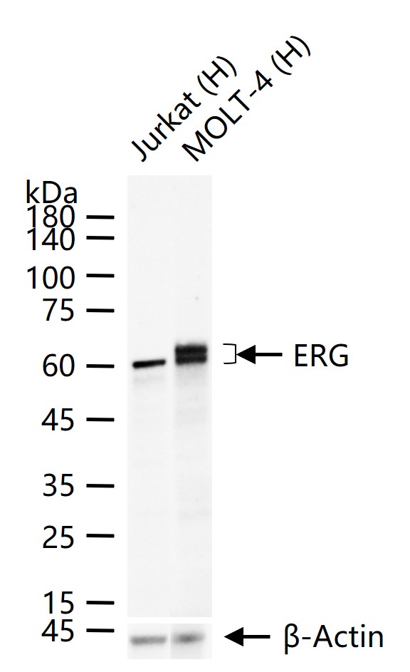 癌基因ERG重组兔单抗-bsm-52324R