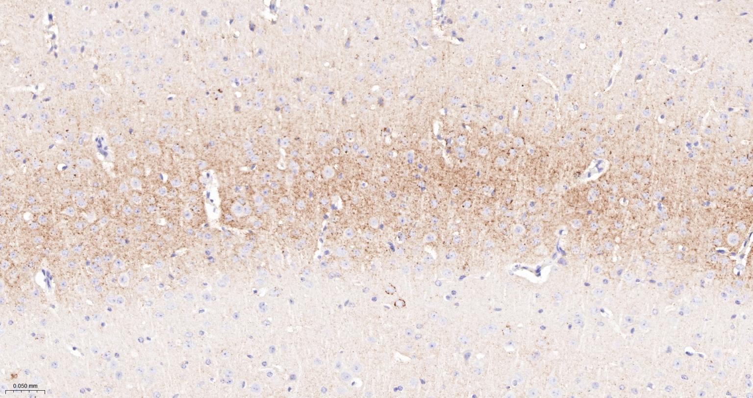 CD15/SSEA1重组兔单抗-bsm-60940R