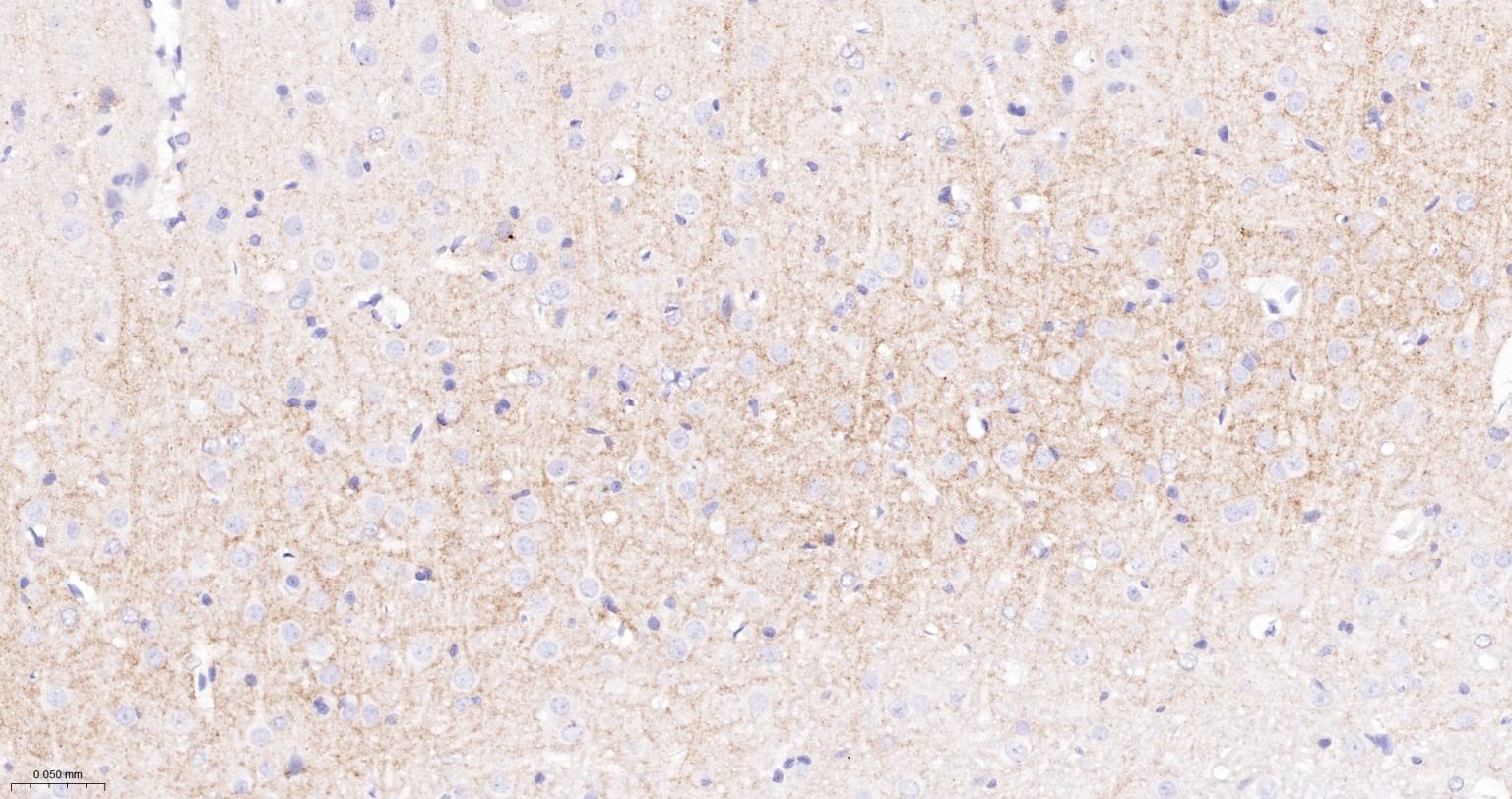 CD15/SSEA1重组兔单抗-bsm-60940R