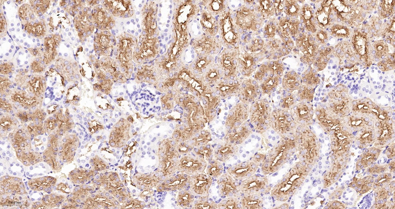 CD15/SSEA1重组兔单抗-bsm-60940R