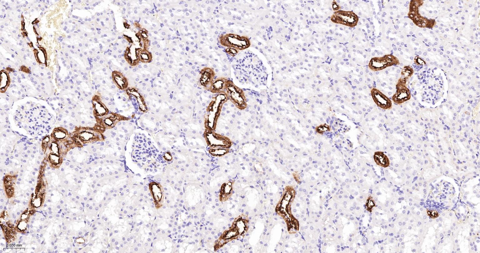 CD15/SSEA1重组兔单抗-bsm-60940R