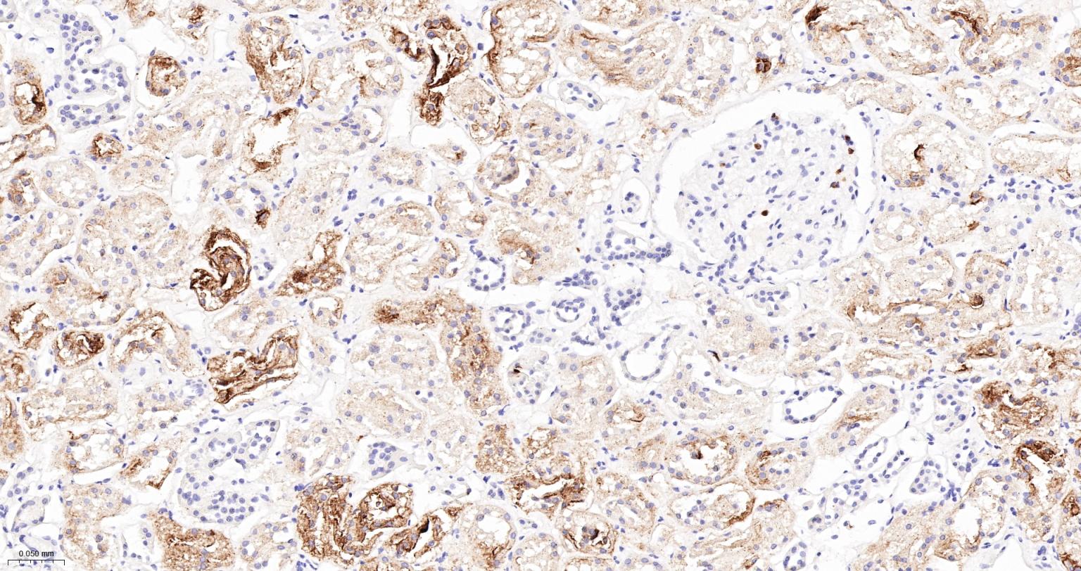 CD15/SSEA1重组兔单抗-bsm-60940R