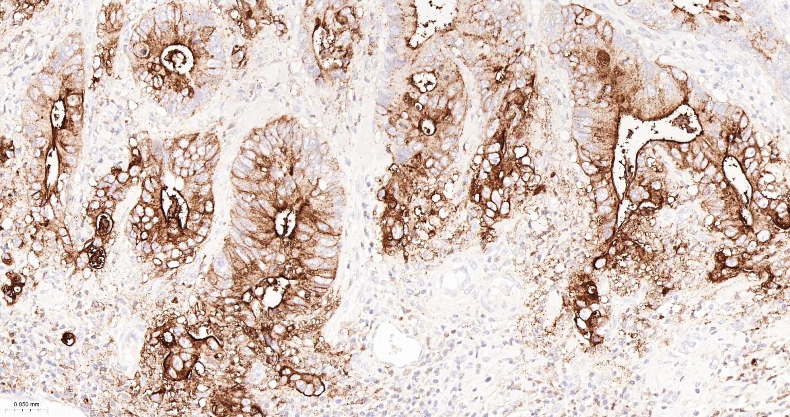 CD15/SSEA1重组兔单抗-bsm-60940R