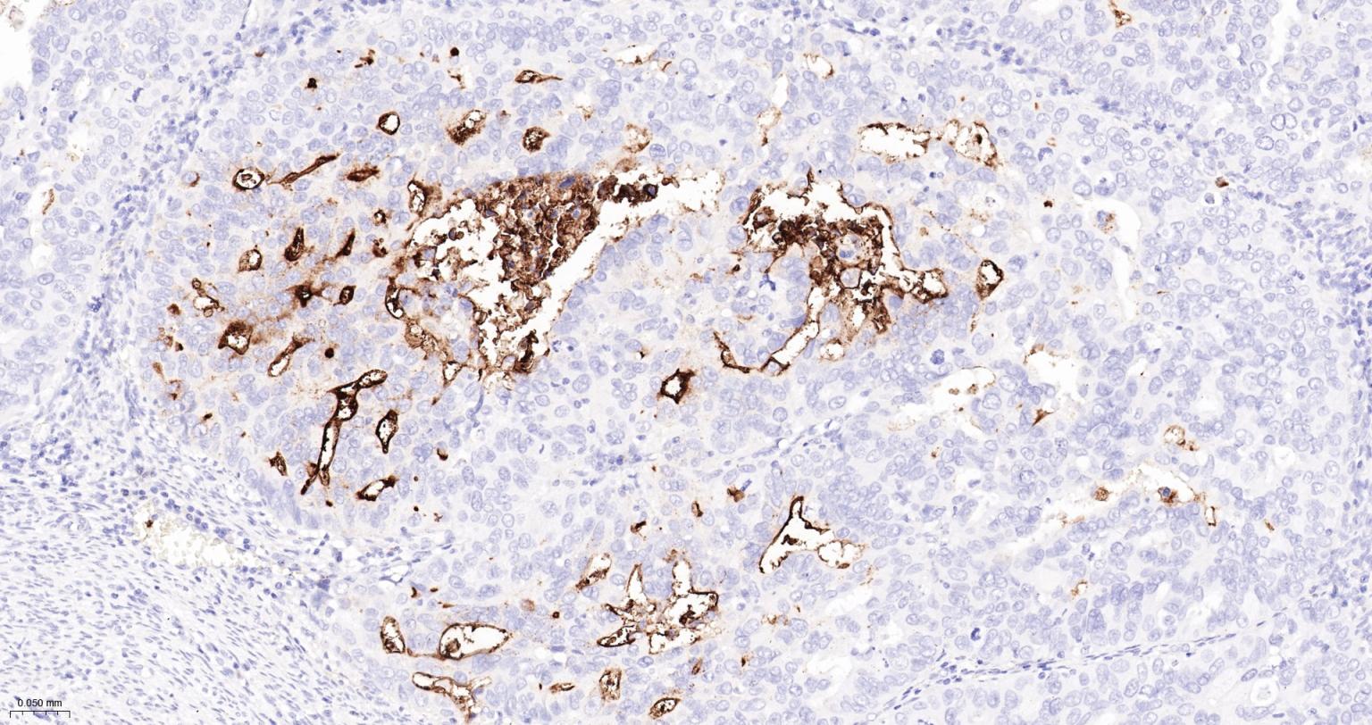 CD15/SSEA1重组兔单抗-bsm-60940R