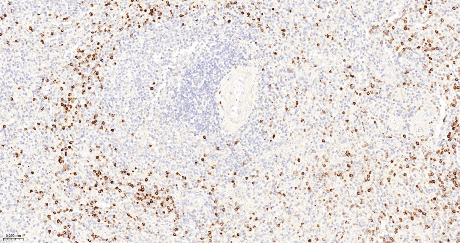 CD15/SSEA1重组兔单抗-bsm-60940R