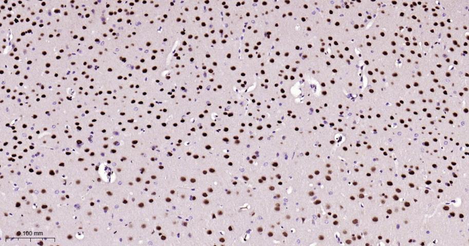 肌细胞增强因子2A/2C重组兔单抗-bsm-62907R