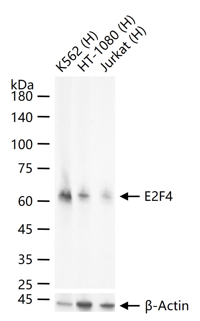 转录因子E2F-4重组兔单抗-bsm-61764R